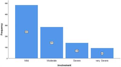 Determining the frequency of thyroid involvement in chest CT scans of COVID-19 patients and its correlation with the severity of lung involvement and survival of patients in 2020